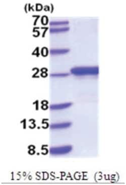 Novus Biologicals Recombinant Mouse Apolipoprotein A-I/ApoA1 His Protein 0.5 mg | Buy Online | Novus Biologicals&trade; | Fisher Scientific
