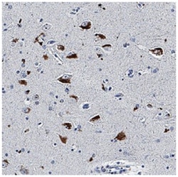 Apolipoprotein E3/ApoE3 Antibody (960319) - Azide and BSA Free, Novus Biologicals