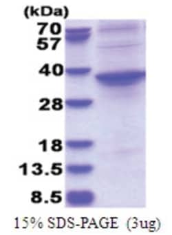 Novus Biologicals&trade;&nbsp;Recombinant Human ASPHD1 His Protein