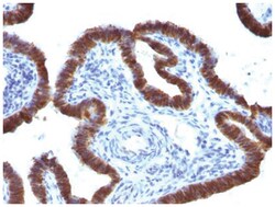 ASRGL1 Antibody (CRASH/1289), Novus Biologicals 0.02mg; Unlabeled:Antibodies,