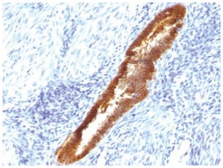 ASRGL1 Antibody (CRASH/1289), Novus Biologicals 0.02mg; Unlabeled:Antibodies,