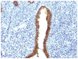 ASRGL1 Antibody (CRASH/1289), Novus Biologicals 0.02mg; Unlabeled:Antibodies,