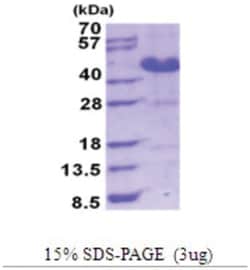 Novus Biologicals&trade;&nbsp;Recombinant Human ASRGL1 His Protein