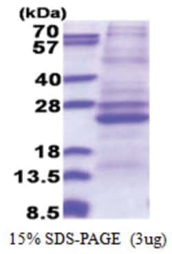 Novus Biologicals Recombinant Human ATP5F1 His Protein 0.1 mg | Buy Online | Novus Biologicals&trade; | Fisher Scientific