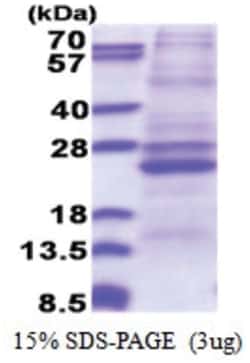 Novus Biologicals Recombinant Human ATP5F1 His Protein 0.1 mg | Buy Online | Novus Biologicals&trade; | Fisher Scientific