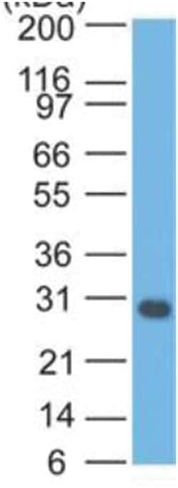 Bcl-xL Mouse, Clone: 2H12, Novus Biologicals:Antibodies:Primary Antibodies