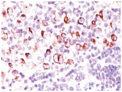 Bcl-xL, Clone: BX006 + 2H12, Novus Biologicals 0.02mg; Unlabeled:Antibodies,