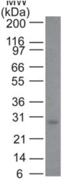 Bcl-2 Mouse, Clone: SPM117, Novus Biologicals:Antibodies:Primary Antibodies