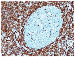 Bcl-2 Mouse, Clone: 124, Novus Biologicals 0.02mg; Unlabeled:Antibodies,