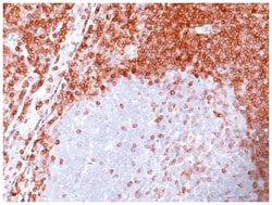 Bcl-2 Mouse, Clone: SPM117, Novus Biologicals:Antibodies:Primary Antibodies
