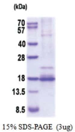 Novus Biologicals Recombinant Human BDNF His Protein 0.1 mg | Buy Online | Novus Biologicals&trade; | Fisher Scientific