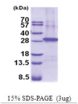 Novus Biologicals&trade;&nbsp;Recombinant Human beta Sarcoglycan His Protein