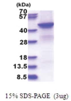 Novus Biologicals&trade;&nbsp;Recombinant Human BHMT2 His Protein