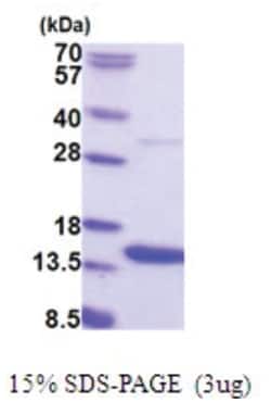 Novus Biologicals&trade;&nbsp;Recombinant Human AAMDC His Protein