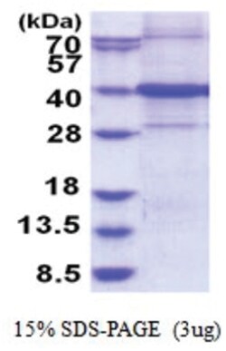 Novus Biologicals&trade;&nbsp;Recombinant Human ARHGEF39 His Protein