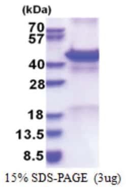 Novus Biologicals&trade;&nbsp;Recombinant Human Calreticulin-2/CALR3 Protein