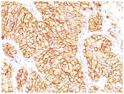 Carbonic Anhydrase IX/CA9 Mouse, Clone: SPM314, Novus Biologicals 0.02mg;