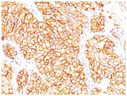 Carbonic Anhydrase IX/CA9 Mouse, Clone: SPM487, Novus Biologicals:Antibodies:Primary