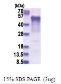 Novus Biologicals&trade;&nbsp;Recombinant Human Casein Kinase 1 delta His Protein