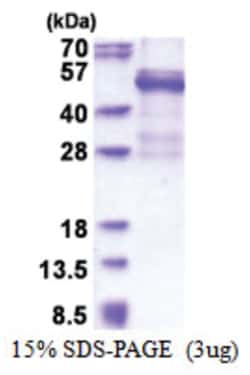 Novus Biologicals Recombinant Human Cathepsin W His Protein 0.25 mg | Buy Online | Novus Biologicals&trade; | Fisher Scientific