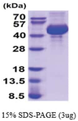 Novus Biologicals&trade;&nbsp;Recombinant Mouse Cathepsin L1 His Protein