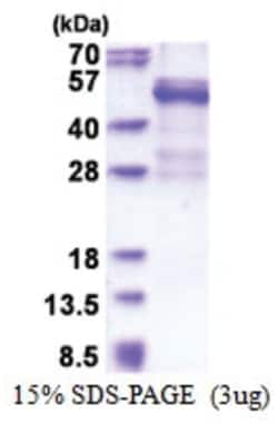 Novus Biologicals Recombinant Human Cathepsin W His Protein 0.25 mg | Buy Online | Novus Biologicals&trade; | Fisher Scientific
