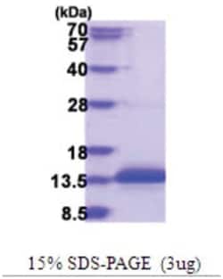 Novus Biologicals&trade;&nbsp;Recombinant Human CCDC23 His Protein