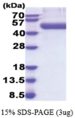 Novus Biologicals&trade;&nbsp;Recombinant Mouse CD14 His Protein