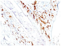 CD1a Antibody (O10+C1A/711), Novus Biologicals 0.02mg; Unlabeled:Antibodies,