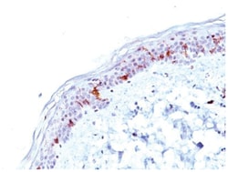 CD1a Antibody (O10), Novus Biologicals 0.1mg; Unlabeled:Antibodies, Monoclonal