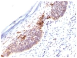 CD1a Antibody (SPM120), Novus Biologicals 0.1mg; Unlabeled:Antibodies,