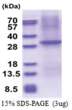 Novus Biologicals&trade;&nbsp;Recombinant Human CD1e His Protein
