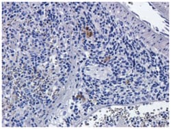 CD25/IL-2R alpha Antibody (Basiliximab) - Chimeric - Azide and BSA Free,