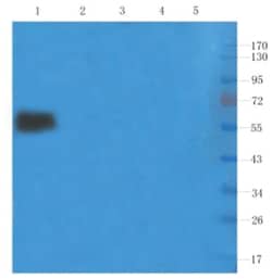CD25/IL-2R alpha Antibody (Basiliximab) - Chimeric - Azide and BSA Free,