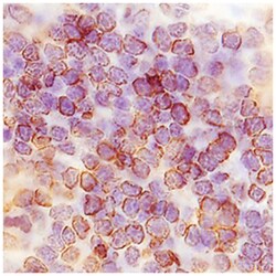 TMIGD2 Antibody (953730) - Azide and BSA Free, R D Systems 100&mu;g; Unlabeled:Antibodies,