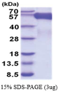 Novus Biologicals&trade;&nbsp;Recombinant Human CD30/TNFRSF8 His Protein
