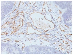 CD31/PECAM-1 Mouse, Clone: C31.3 + JC/70A, Novus Biologicals 0.02mg; Unlabeled:Antibodies,