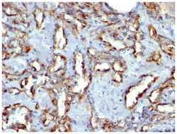 CD31/PECAM-1 Mouse, Clone: C31.3 + JC/70A, Novus Biologicals 0.02mg; Unlabeled:Antibodies,