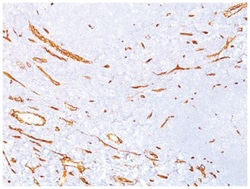 CD34 Mouse, Clone: QBEnd/10, Novus Biologicals 0.02mg; Unlabeled:Antibodies,