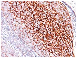 CD35 Mouse, Clone: SPM554, Novus Biologicals 0.02mg; Unlabeled:Antibodies,