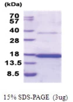 Novus Biologicals&trade;&nbsp;Recombinant Human CD37 His Protein