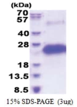 Novus Biologicals&trade;&nbsp;Recombinant Human CD40/TNFRSF5 His Protein