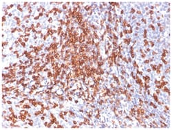 CD44 Mouse, Clone: SPM544, Novus Biologicals 0.2mg; Unlabeled:Antibodies,