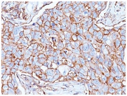 CD44 Mouse, Clone: SPM544, Novus Biologicals 0.2mg; Unlabeled:Antibodies,