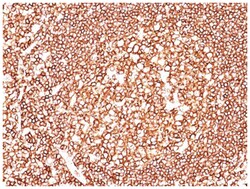 CD45 Antibody (SPM570), Novus Biologicals:Antibodies:Primary Antibodies