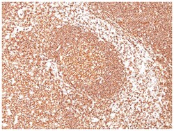 CD45 Antibody (SPM570), Novus Biologicals:Antibodies:Primary Antibodies
