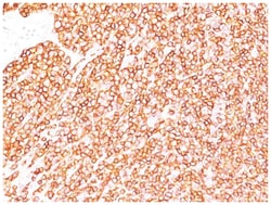 CD45RB Mouse, Clone: BRA-11 (same as BRA-11G), Novus Biologicals 0.02mg;