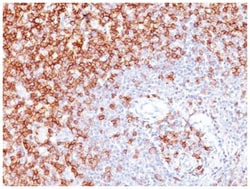 CD45RO Mouse, Clone: SPM125, Novus Biologicals 0.2mg; Unlabeled:Antibodies,