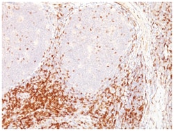 CD5 Mouse, Clone: CD5/54/F6, Novus Biologicals:Antibodies:Primary Antibodies