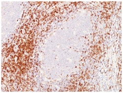 CD6 Antibody (C6/372+3F7B5), Novus Biologicals:Antibodies:Primary Antibodies
